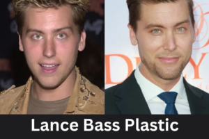 Lance Bass Plastic Surgery