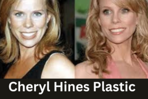 Cheryl Hines Plastic Surgery