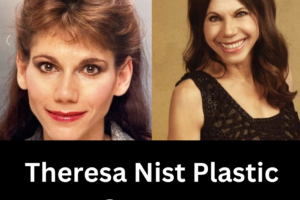 Theresa Nist Plastic Surgery