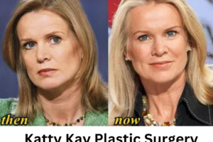 Katty Kay Plastic Surgery