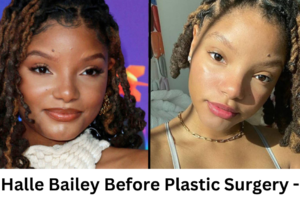 Halle Bailey Before Plastic Surgery