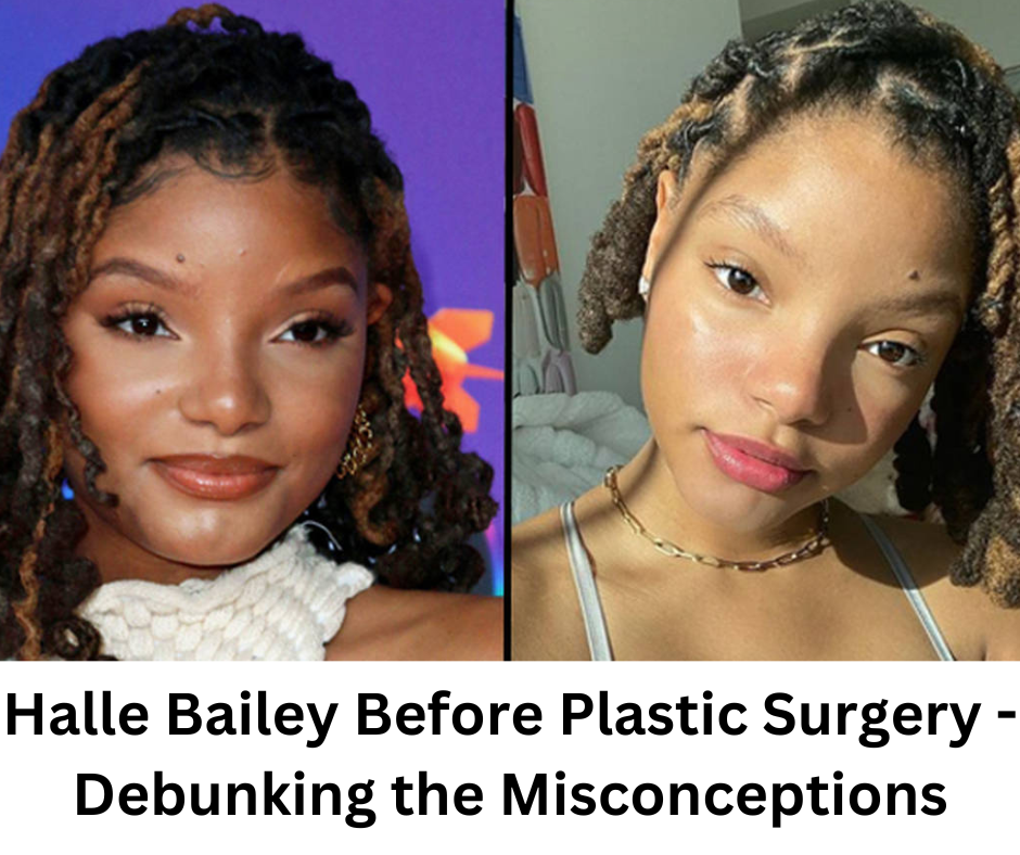 Halle Bailey Before Plastic Surgery Debunking the Misconceptions