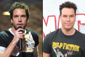 Dane Cook Plastic Surgery