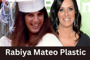 Rabiya Mateo Plastic Surgery