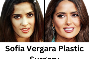 Sofia Vergara Plastic Surgery