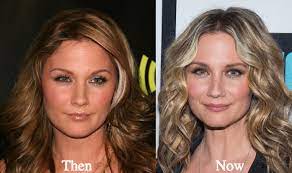 Jennifer Nettles Plastic Surgery