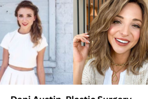 Dani Austin Plastic Surgery