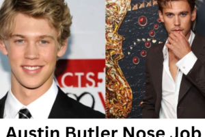 Austin Butler Nose Job