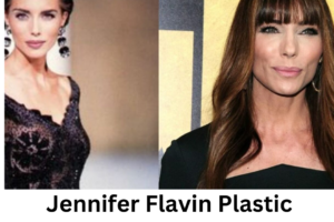 Jennifer Flavin Plastic Surgery