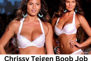 Chrissy Teigen Boob Job