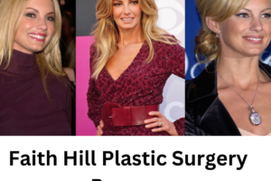 Faith Hill Plastic Surgery