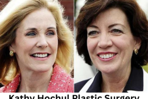 Kathy Hochul Plastic Surgery