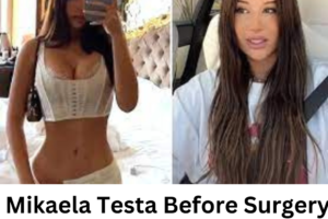 Mikaela Testa Before Surgery