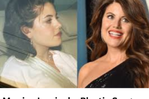 Monica Lewinsky Plastic Surgery