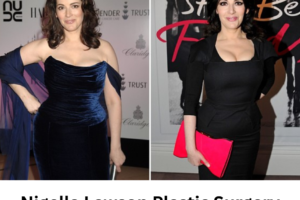 Nigella Lawson Plastic Surgery