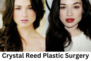 Crystal Reed Plastic Surgery Rumors