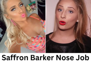 Saffron Barker Nose Job