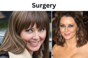 Carol Vorderman Plastic Surgery