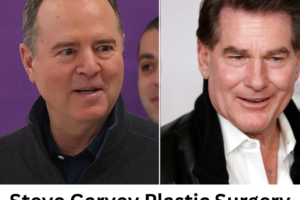 STEVE GARVEY PLASTIC SURGERY