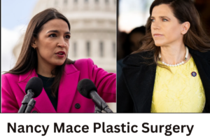Nancy Mace Plastic Surgery