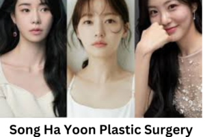 Song Ha Yoon Plastic Surgery