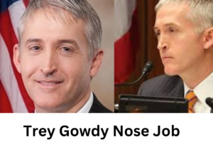 Trey Gowdy Nose Job