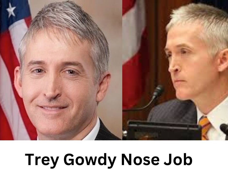 Trey Gowdy Nose Job: Exploring the Truth Behind the Rumors - Celebrity Plastic Surgery
