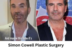 Simon Cowell Plastic Surgery