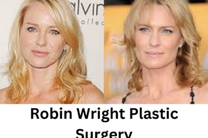 Robin Wright Plastic Surgery