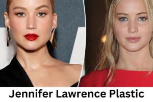 Jennifer Lawrence Plastic Surgery: Analyzing the Rumors