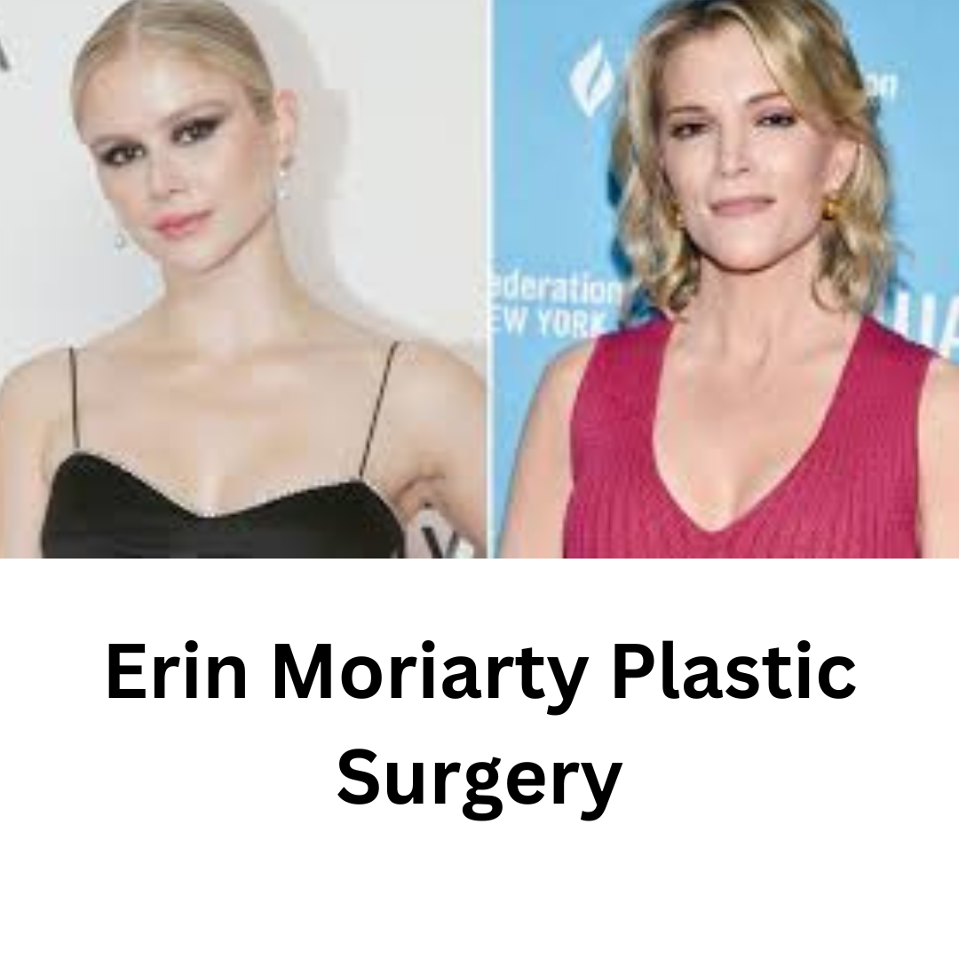 Erin Moriarty Plastic Surgery Rumors - Celebrity Plastic Surgery