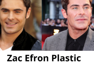 Zac Efron Plastic Surgery