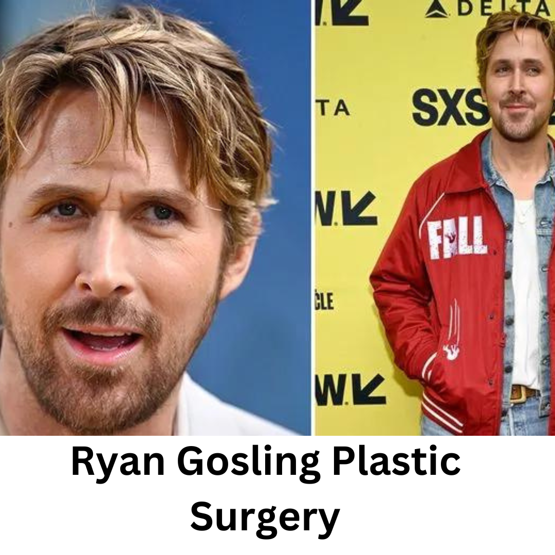 Ryan Gosling Plastic Surgery Has Ryan Gosling Had Plastic Surgery? Celebrity Plastic Surgery