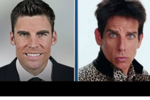 Wally Szczerbiak Plastic Surgery