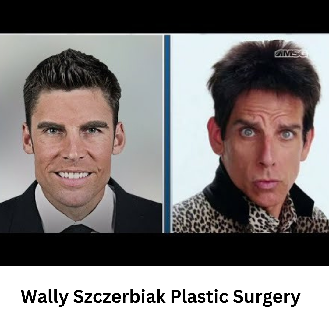 The Truth About Wally Szczerbiak Plastic Surgery Transformation