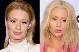 Iggy Azalea Plastic Surgery