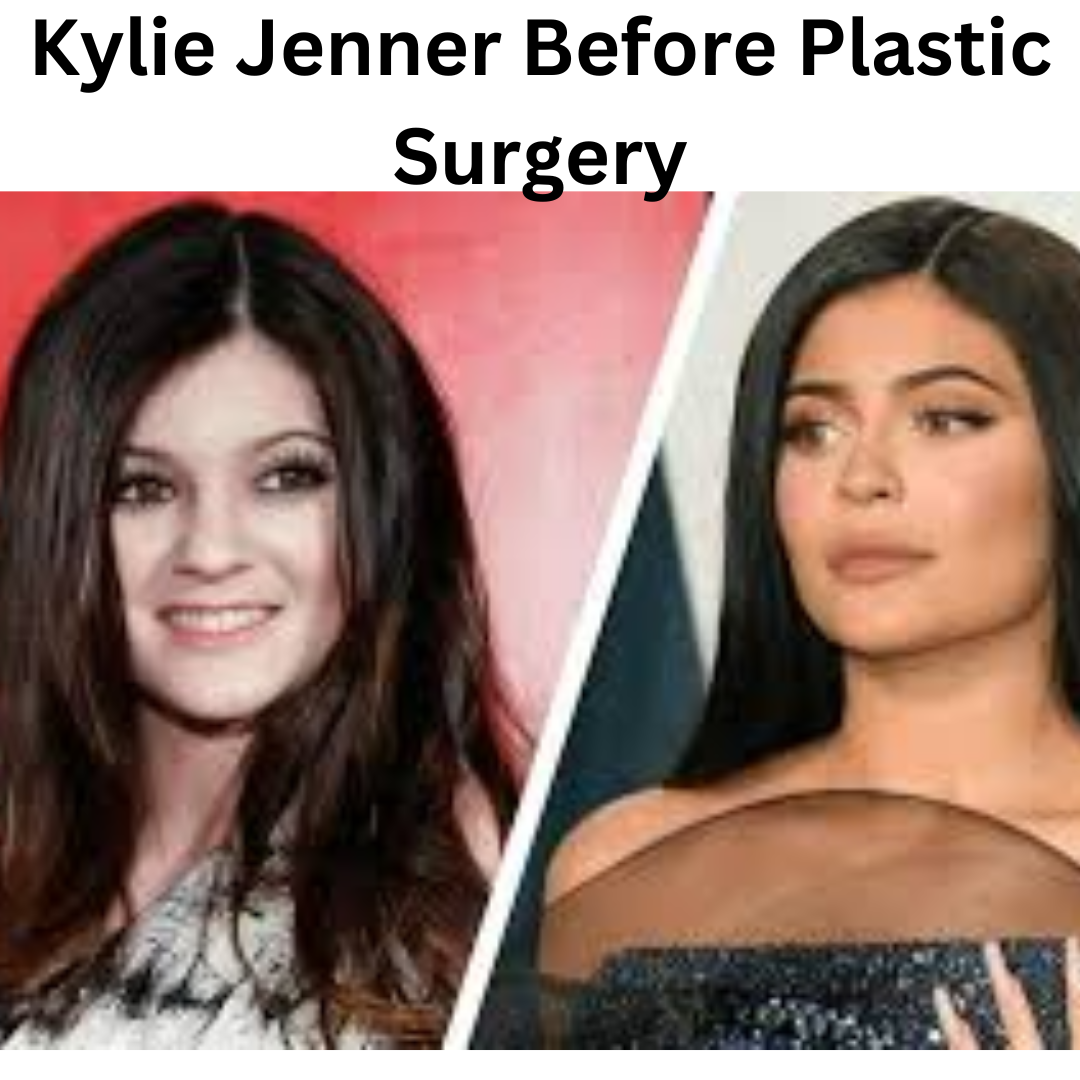Kylie Jenner Before Plastic Surgery: The Evolution of a Beauty Icon