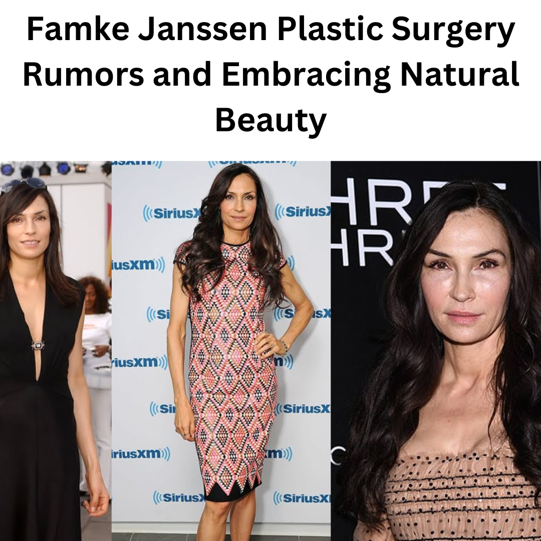 Famke Janssen Plastic Surgery Rumors and Embracing Natural Beauty Celebrity Plastic Surgery
