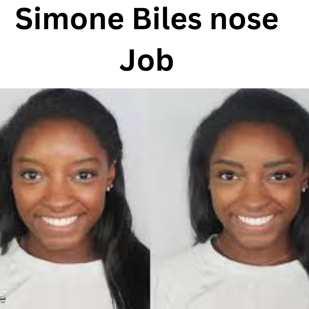 simone biles nose job Image 3