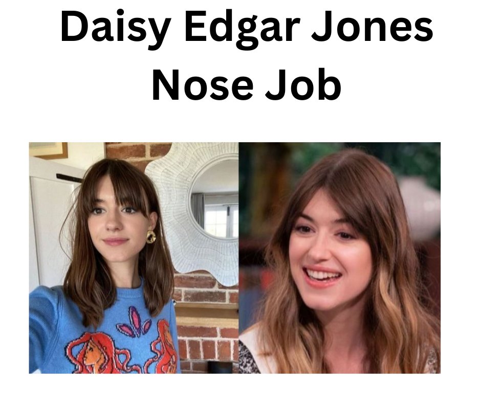 daisy edgar jones nose job Image 6