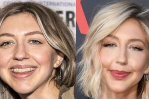Heidi Gardner Plastic Surgery