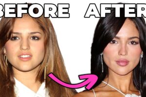 Eiza González Before Plastic Surgery