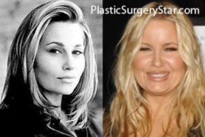 Jennifer Coolidge Before Plastic Surgery