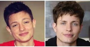 Matt Rife Before and After Plastic Surgery Rumors and His Dramatic Transformation