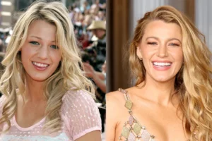 blake-lively-nose
