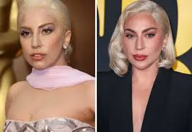 Lady Gaga Nose Job