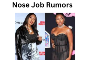 Megan Thee Stallion Nose Job Rumors
