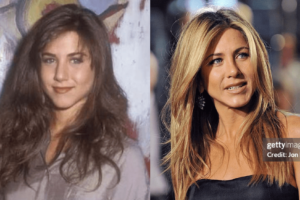 Jennifer Aniston Nose Job