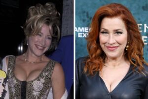 Lisa Ann Walter Plastic Surgery