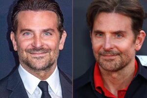 Bradley Cooper Before and After Plastic Surgery